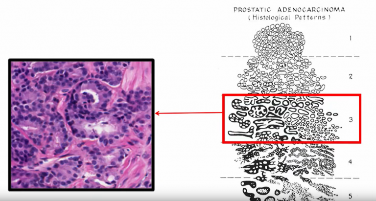 Best of TedX: AI vs. pathologists: survival of the fittest